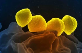 Jepang melaporkan rekor lonjakan infeksi bakteri yang berpotensi mematikan